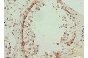Immunohistochemistry of paraffin-embedded human testis tissue using ABIN7144880 at dilution of 1:100 (ABCA3 anticorps  (AA 43-203))