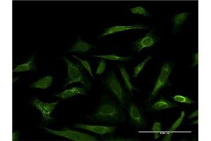 Immunofluorescence of monoclonal antibody to LGALS3 on HeLa cell.