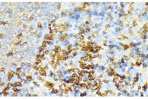 Immunohistochemistry of paraffin-embedded Rat spleen using SPTA1 Polyclonal Antibody at dilution of 1:100 (40x lens).