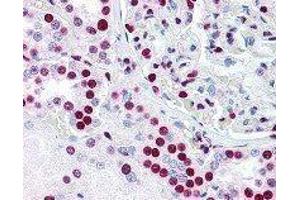 Immunohistochemistry (IHC) image for anti-Polypyrimidine Tract Binding Protein 1 (PTBP1) antibody (ABIN2665344)