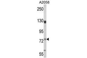 Western blot analysis of MCAM Antibody (MCAM anticorps  (Middle Region))