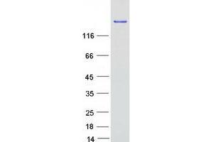 Validation with Western Blot