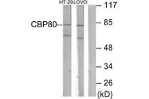 Western blot analysis of extracts from HT-29/LOVO cells, using NCBP1 Antibody. (NCBP1 anticorps  (AA 1-50))