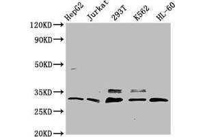 Western Blot Positive WB detected in: HepG2 whole cell lysate, Jurkat whole cell lysate, 293T whole cell lysate, K562 whole cell lysate, HL-60 whole cell lysate All lanes: GEMIN2 antibody at 3. (SIP1 anticorps  (AA 1-280))