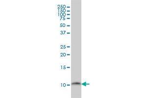 PCBD1 monoclonal antibody (M01), clone 1G11-H5 Western Blot analysis of PCBD1 expression in C32 .