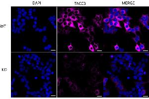 anti-Transforming, Acidic Coiled-Coil Containing Protein 3 (TACC3) antibody
