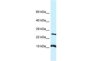 WB Suggested Anti-Vamp8 Antibody Titration: 1. (VAMP8 anticorps  (Middle Region))