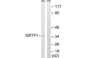 Western Blotting (WB) image for anti-Growth Hormone Regulated TBC Protein 1 (GRTP1) (Internal Region) antibody (ABIN1851386) (GRTP1 anticorps  (Internal Region))