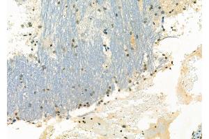 ABIN6263648 and ABIN6266600 at 1/100 staining Rat brain tissue by IHC-P. (NKX3-1 anticorps  (Internal Region))