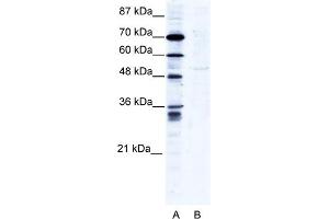WB Suggested Anti-ZNF134 Antibody Titration:  2. (ZNF134 anticorps  (N-Term))