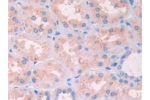 Used in DAB staining on fromalin fixed paraffin- embedded stomach cancer tissue (RNASE12 anticorps  (AA 21-147))