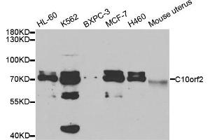 Western Blotting (WB) image for anti-Chromosome 10 Open Reading Frame 2 (C10ORF2) antibody (ABIN1876491) (C10orf2 anticorps)