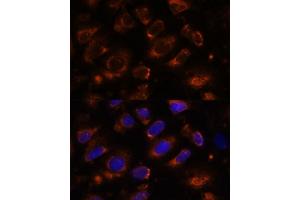 Immunofluorescence analysis of U-2 OS cells using TENM1 antibody (ABIN7270767) at dilution of 1:100. (ODZ1/Teneurin 1 anticorps  (AA 350-540))
