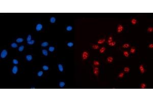 IF analysis of AKAP 95/AKAP8 using anti-AKAP 95/AKAP8 antibody (ABIN7601553). (AKAP8 anticorps  (AA 380-546))