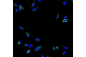 IF analysis of Calpain 2 using anti-Calpain 2 antibody (ABIN5518897). (Calpain 2 anticorps  (AA 500-700))