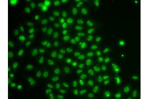 Immunofluorescence analysis of U2OS cells using TOX antibody (ABIN5974241). (TOX anticorps)
