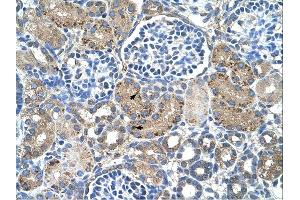 Immunohistochemistry (IHC) image for anti-Glutaminase 2 (Liver, Mitochondrial) (GLS2) (Middle Region) antibody (ABIN2781319) (GLS2 anticorps  (Middle Region))