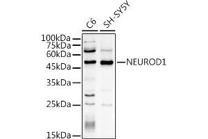 Western blot analysis of extracts of various cell lines, using NEUROD1 antibody (ABIN3021547, ABIN3021548, ABIN3021549, ABIN1513255 and ABIN6215228) at 1:500 dilution. (NEUROD1 anticorps  (AA 1-70))