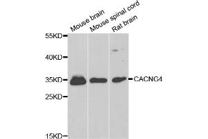 Western blot analysis of extracts of various cell lines, using CACNG4 antibody (ABIN5974747) at 1/1000 dilution. (CACNG4 anticorps)