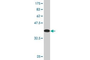 Western Blot detection against Immunogen (37.