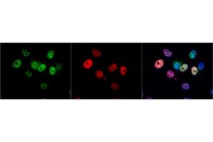 ICC/IF Image CDK4 antibody detects CDK4 protein at nucleus by immunofluorescent analysis.