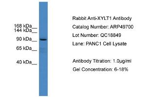 WB Suggested Anti-XYLT1  Antibody Titration: 0. (XYLT1 anticorps  (Middle Region))