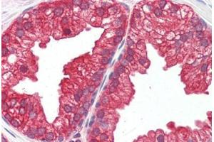 Human Prostate (formalin-fixed, paraffin-embedded) stained with MAP2K1 antibody ABIN461964 at 10 ug/ml followed by biotinylated goat anti-rabbit IgG secondary antibody ABIN481713, alkaline phosphatase-streptavidin and chromogen.