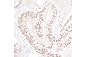 Immunohistochemistry (IHC) image for anti-Ubiquitin-Like, Containing PHD and RING Finger Domains, 1 (UHRF1) (AA 275-325) antibody (ABIN7453638)