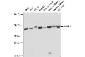 Western blot analysis of extracts of various cell lines, using  Rabbit mAb (ABIN1682191, ABIN3017949, ABIN3017950 and ABIN7101542) at 1:1000 dilution.