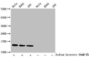 Western Blot Detected samples: Hela whole cell lysate, K562 whole cell lysate, 293 whole cell lysate, Untreated (-) or treated (+) with 30 mM sodium butyrate for 4h All lanes: HIST1H2BC antibody at 1:1000 Secondary Goat polyclonal to rabbit IgG at 1/40000 dilution Predicted band size: 14 kDa Observed band size: 14 kDa