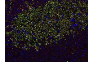 Indirect immunostaining of PFA fixed paraffin embedded mouse hippocampus section with anti-Homer 3 (dilution 1 : 500; red) and guinea pig anti-ZnT 3 (ABIN1742413, dilution 1 : 500; green). (HOMER3 anticorps  (AA 1-177))