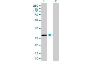 Western Blot analysis of CLIC2 expression in transfected 293T cell line by CLIC2 MaxPab polyclonal antibody. (CLIC2 anticorps  (AA 1-247))