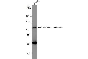 WB Image Whole cell extract (30 μg) was separated by 7. (OGT anticorps  (N-Term))