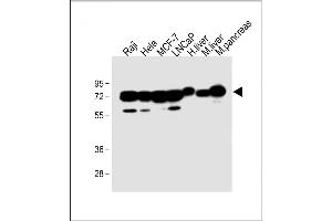 All lanes : Anti-CBS Antibody (Center) at 1:2000 dilution Lane 1: Raji whole cell lysate Lane 2: Hela whole cell lysate Lane 3: MCF-7 whole cell lysate Lane 4: LNCaP whole cell lysate Lane 5: Human liver lysate Lane 6: Mouse liver lysate Lane 7: Mouse pancreas lysate Lysates/proteins at 20 μg per lane. (CBS anticorps  (AA 301-330))
