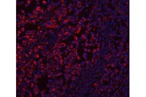 IF analysis of ECHS1 using anti-ECHS1 antibody (ABIN7599813).