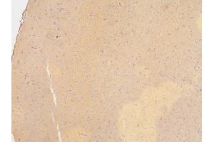 IHC analysis of SLC12A5 using anti-SLC12A5 antibody (ABIN6719415).