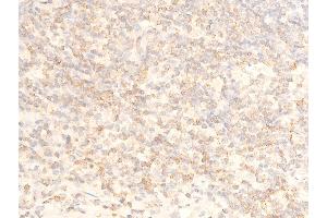 ABIN6267069 at 1/100 staining human appendiceal tissue sections by IHC-P.
