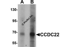 Western Blotting (WB) image for anti-Coiled-Coil Domain Containing 22 (CCDC22) (N-Term) antibody (ABIN1031304) (CCDC22 anticorps  (N-Term))
