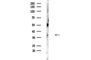Western blot analysis of lysates from HUVEC cells(UV,30 min treatment), using SLC25 Antibody at 1/1000 dilution.