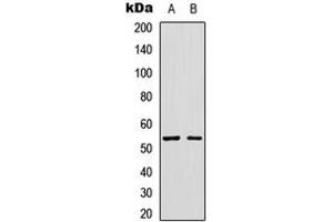 Western blot analysis of GLP-1 Receptor expression in SKNSH (A), HuvEc (B) whole cell lysates.