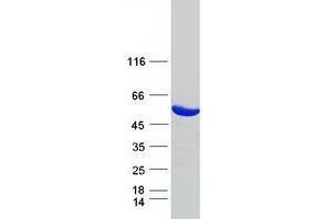 Validation with Western Blot