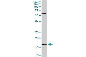 RHEB monoclonal antibody (M01), clone 2C11.