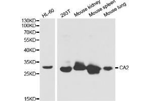 Western blot analysis of extracts of various cell lines, using CA2 antibody (ABIN5970672) at 1/1000 dilution. (CA2 anticorps)