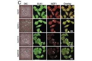 Disrupting the interaction between MZF1 and ELK1 by MZF160-72 interrupts EMT in Hs578T cells.