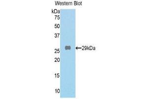 Western Blotting (WB) image for anti-Galactosidase, beta 1 (GLB1) (AA 192-432) antibody (ABIN1859021)