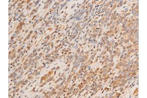 ABIN6267218 at 1/100 staining human appendiceal tissue sections by IHC-P.