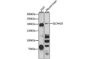 Western blot analysis of extracts of various cell lines, using SLC4A10 antibody (ABIN6292481) at 1:3000 dilution. (SLC4A10 anticorps)