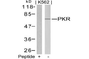Image no. 1 for anti-Eukaryotic Translation Initiation Factor 2-alpha Kinase 2 (EIF2AK2) (Thr446) antibody (ABIN197544) (EIF2AK2 anticorps  (Thr446))