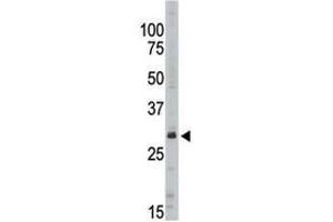 Western blot analysis of SIRT5 antibody in Jurkat lysate