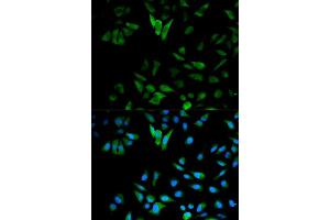 Immunofluorescence analysis of HeLa cell using ENO1 antibody.